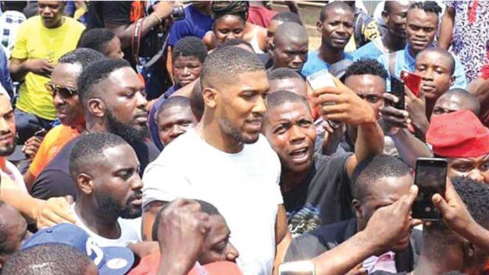 Энтони Жошуа ЙТҲдан сўнг шифохонадан чиқди