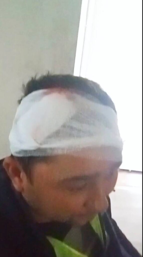 Фарғонада сув таъминоти ходимига ҳужум қилинди