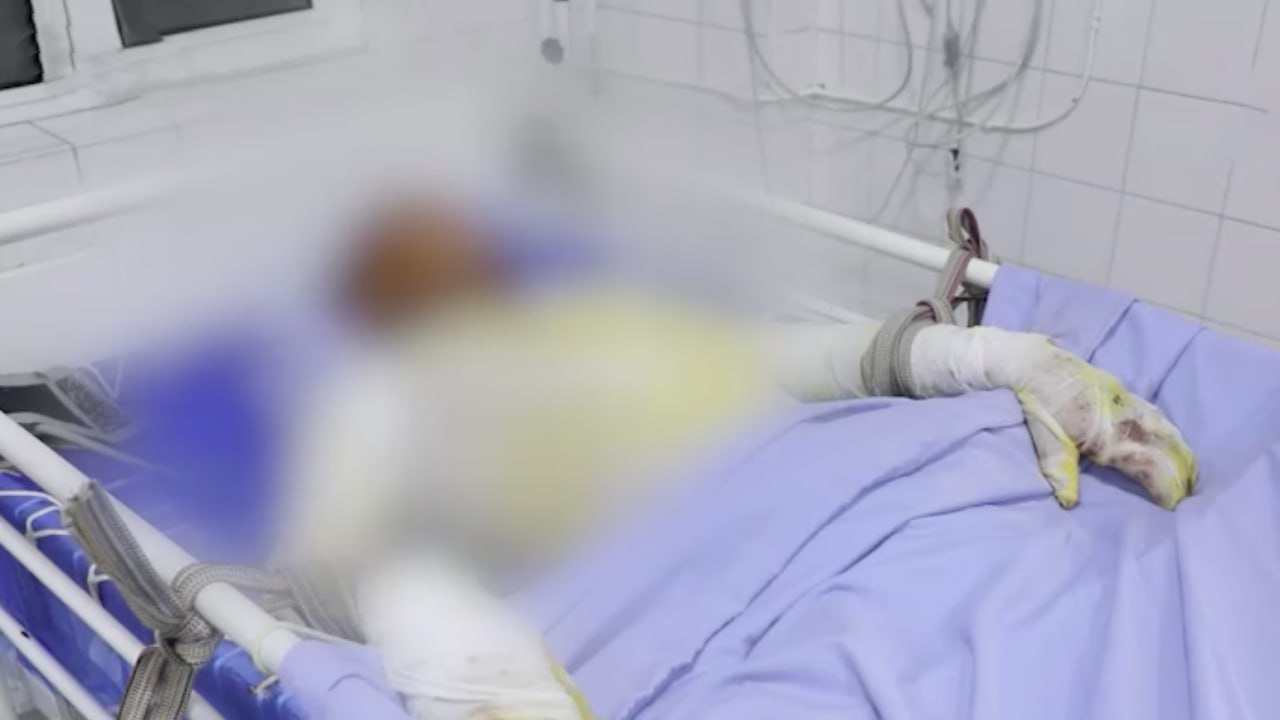 Чирчиқда ўсмир вагон томида селфи қилмоқчи бўлиб, оғир куйиш жароҳатлари олди