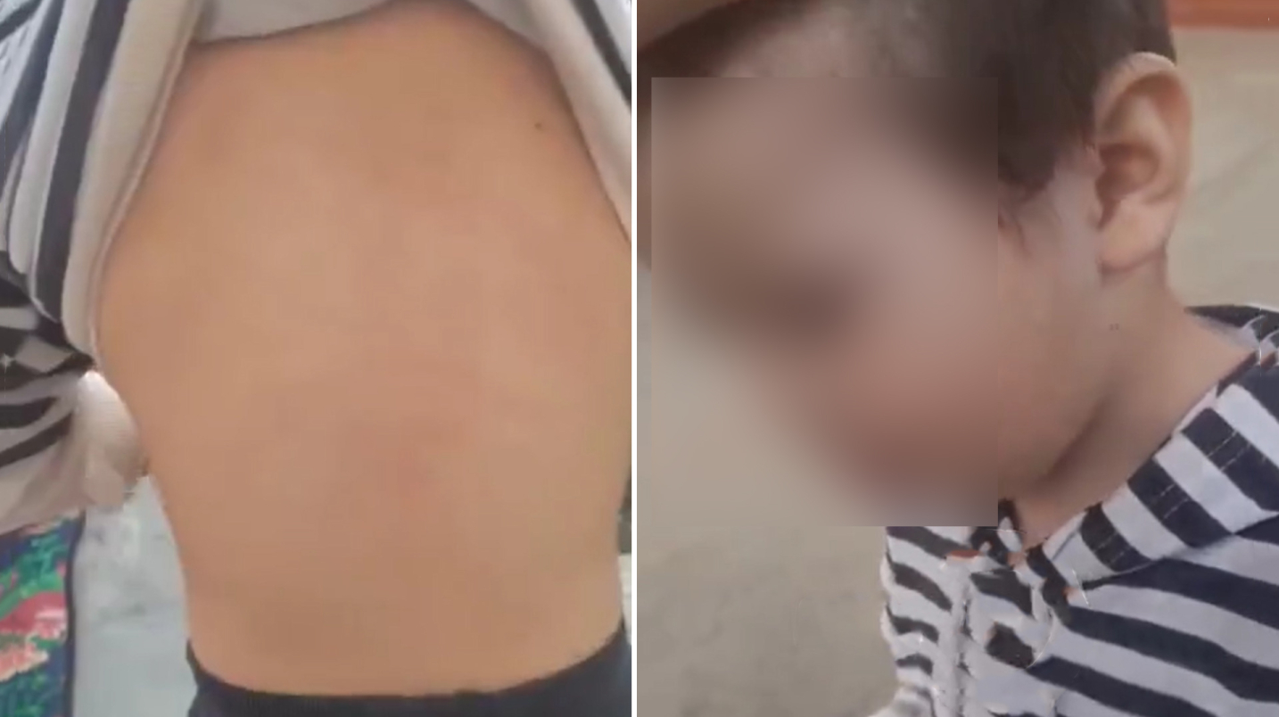 Андижондаги хусусий боғчада 2 ёшли бола калтакланди