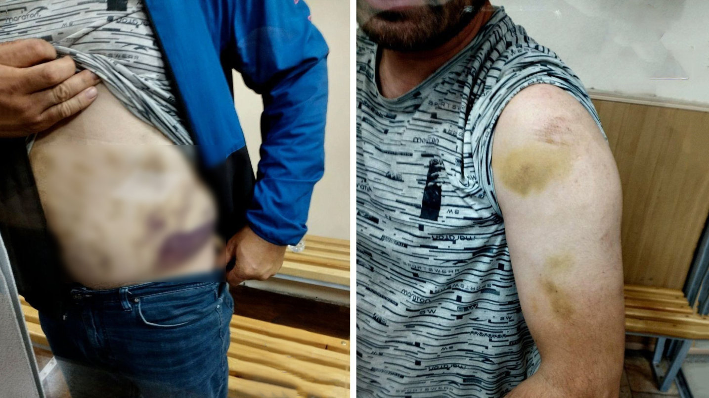 Ҳуқуқ ҳимоячиси талончилик ва бошқа оғир жиноятларда гумон қилинган шахслар қийноққа солинганини маълум қилди