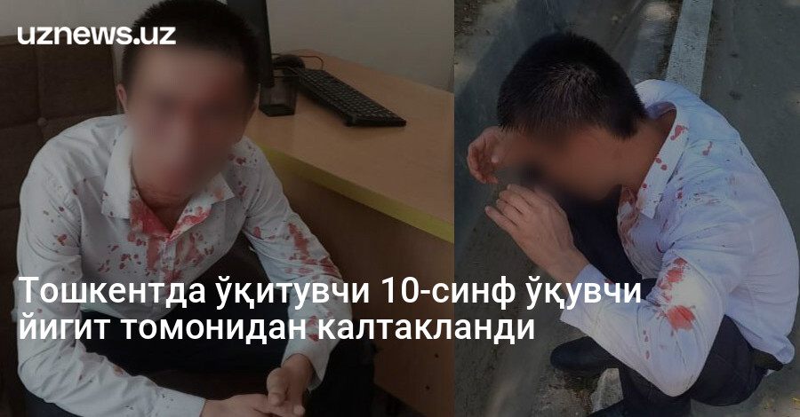 Тошкентда ўқитувчи 10-синф ўқувчи йигит томонидан калтакланди