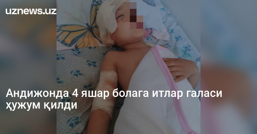 Андижонда 4 яшар болага итлар галаси ҳужум қилди