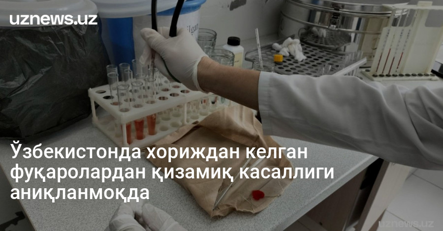 Ўзбекистонда хориждан келган фуқаролардан қизамиқ касаллиги аниқланмоқда